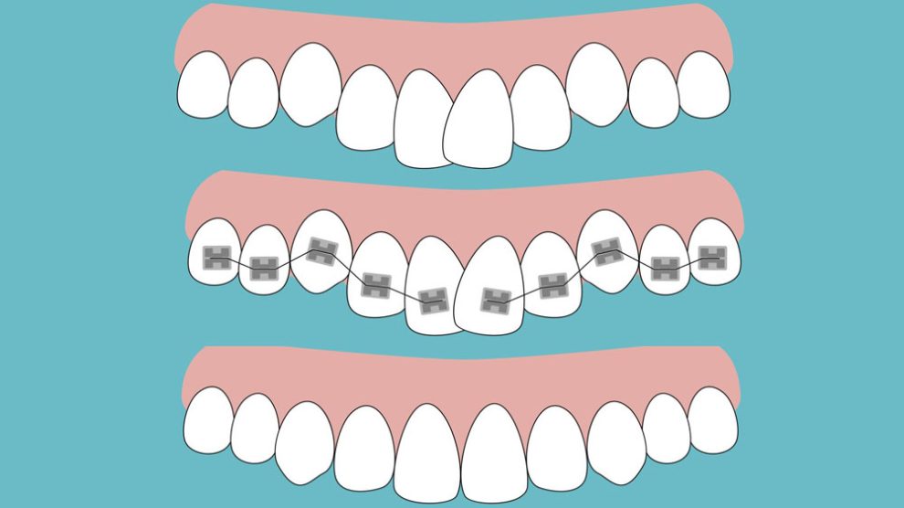 Causes Of Orthodontic Problems Dr Jamilian