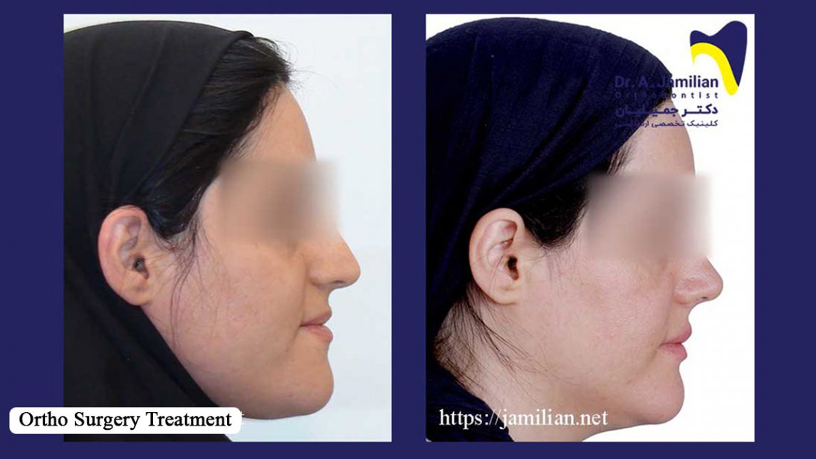 Ortho Surgery Treatments Dr Jamilian