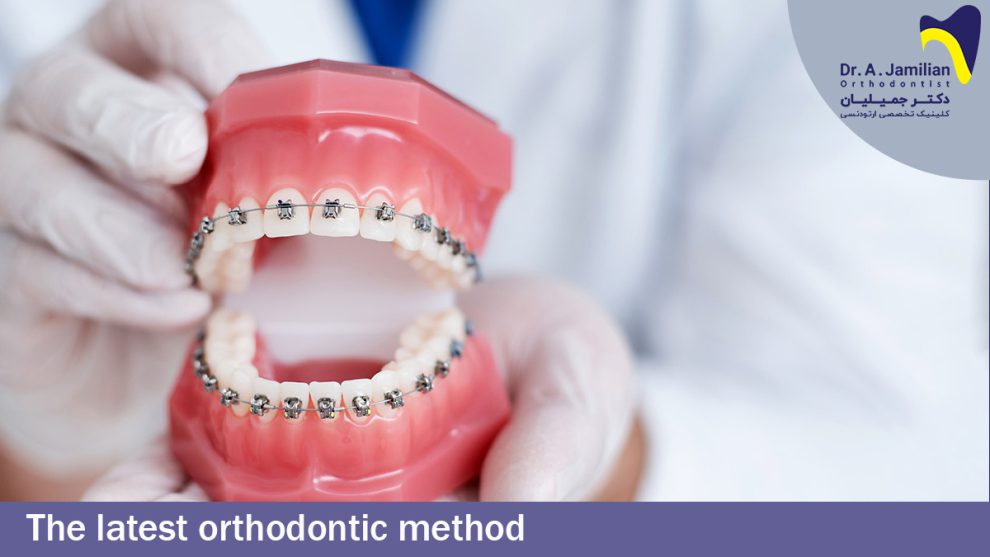 Orthodontic Treatment Dr Jamilian