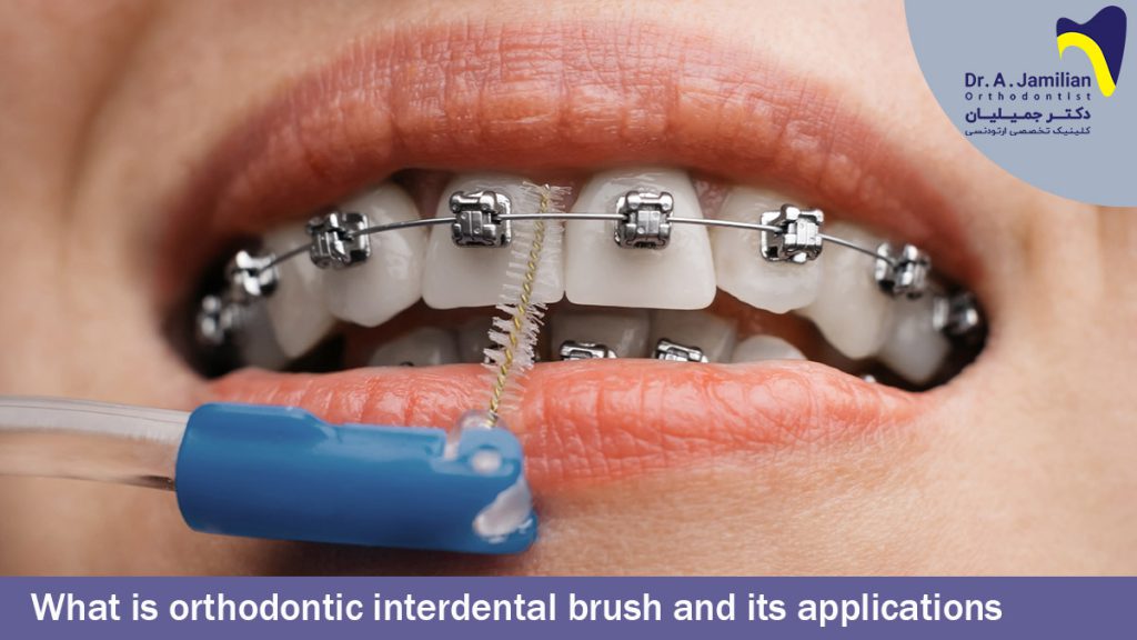 What Is Orthodontic Interdental Brush And Its Applications Dr Jamilian