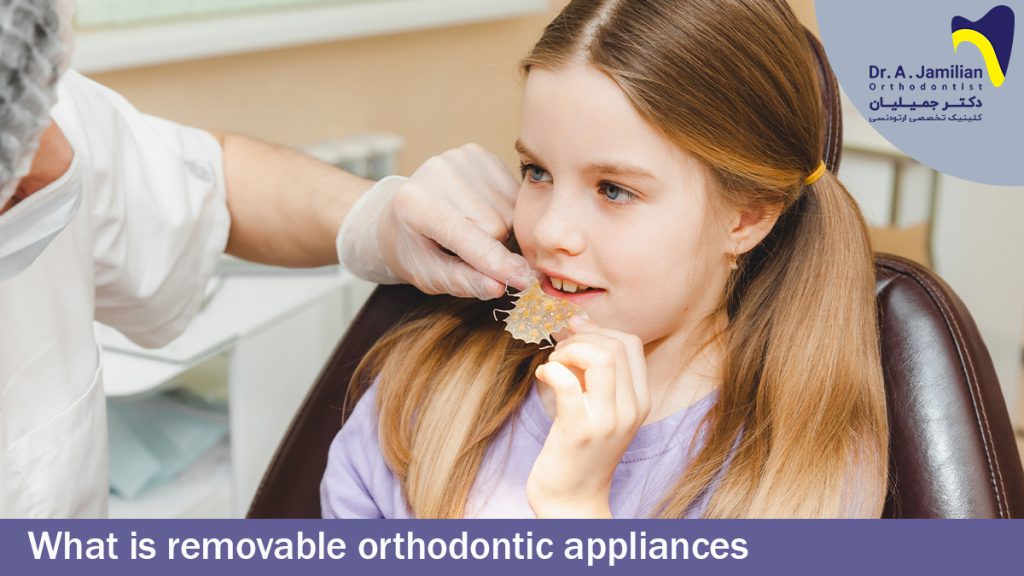 What is Removable Orthodontic Appliances Dr Jamilian
