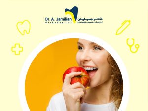خانمی با براکت ارتودنسی و درحال خوردن سیب