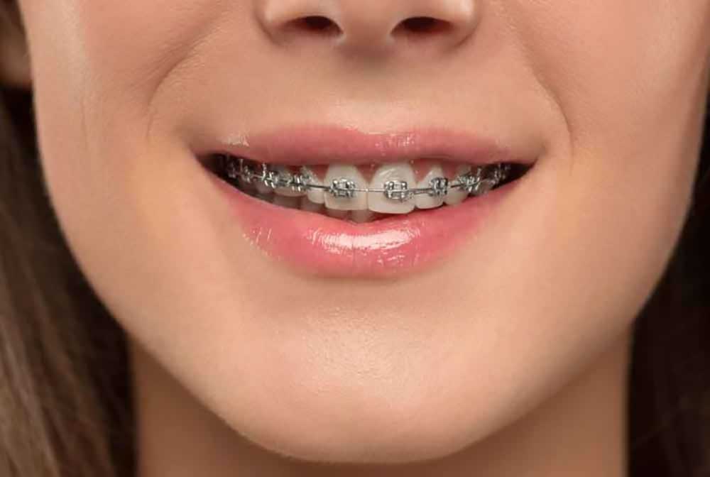 طب الأسنان والفك العظام