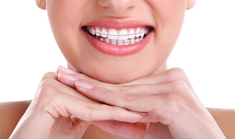 finding the best orthodontist