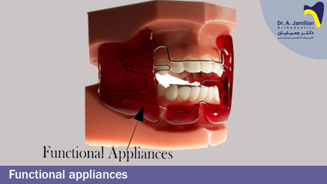 Functional Appliances Orthodontics Functional Appliances Dr Jamilian