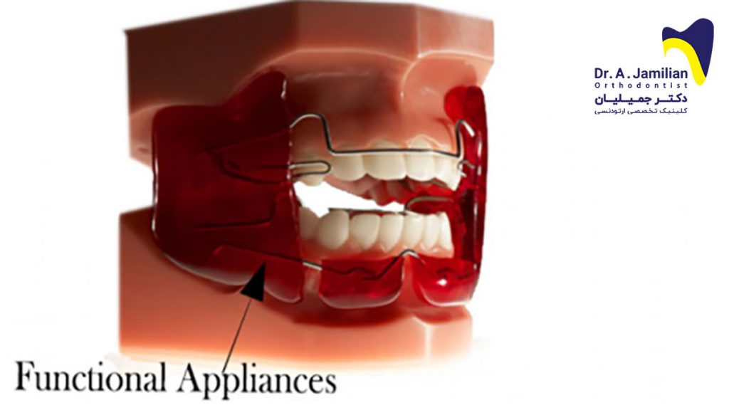 Functional Appliances Orthodontics Functional Appliances Dr Jamilian