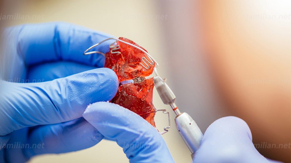 What is Removable Orthodontic Appliances Dr Jamilian