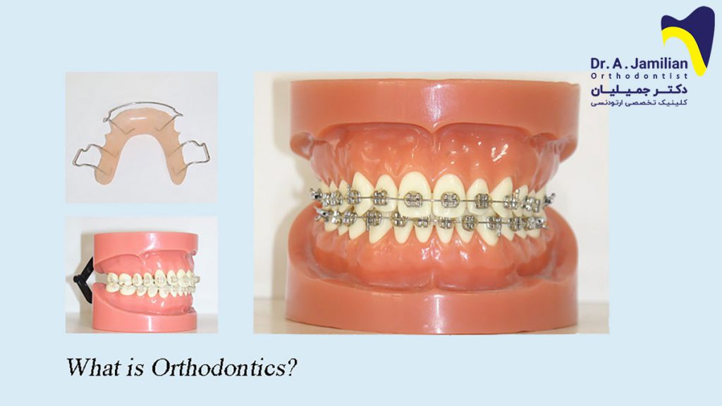 What is Orthodontics Determining orthodontic cost in free visit Dr