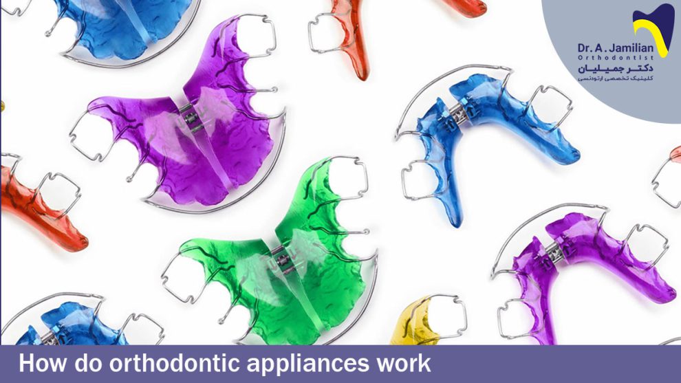 How Do Orthodontic Appliances Work Dr jamilian