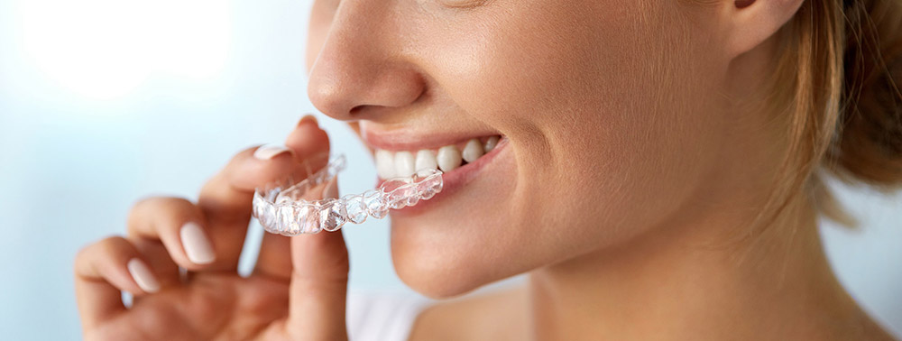 امرأة تخضع لتقويم أسنان شفاف غير مرئي
