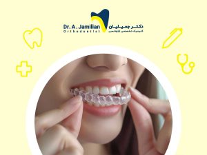 woman putting invisible orthodontics on her teeth