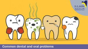 common oral and dental problems
