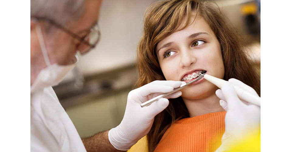 فوائد دامون لتقويم الاسنان