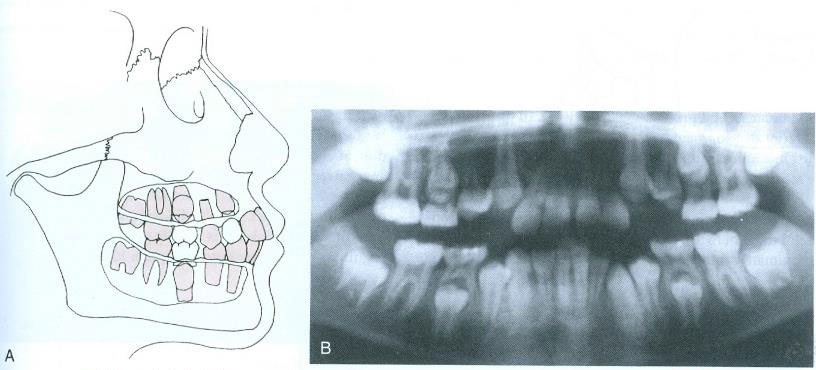 ویژگی سن دندانی