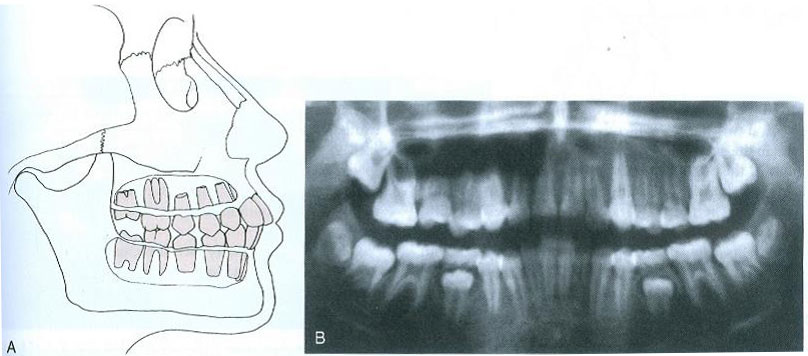 ویژگی سن دندانی