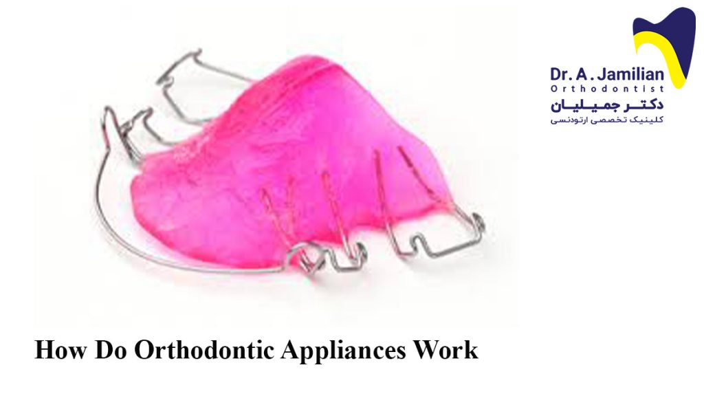 How Do Orthodontic Appliances Work Dr jamilian