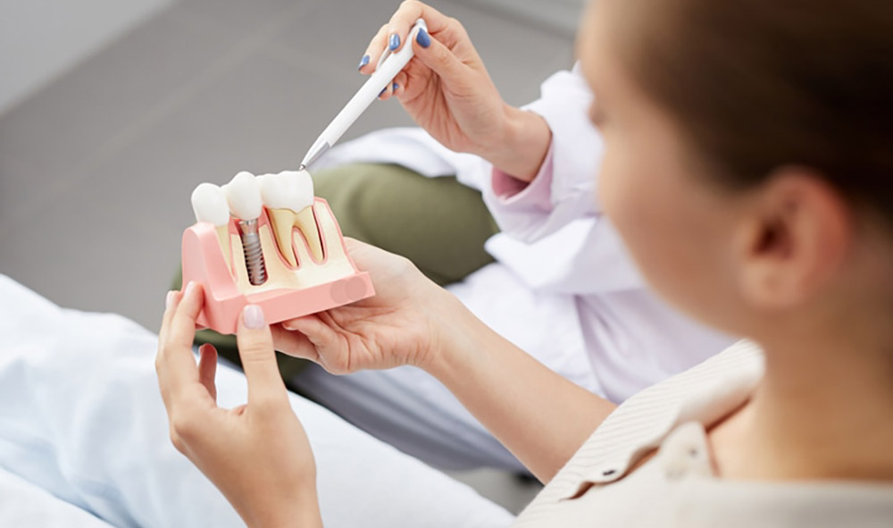 how to take care of dental implants