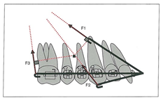 the center of resistance in the maxilla