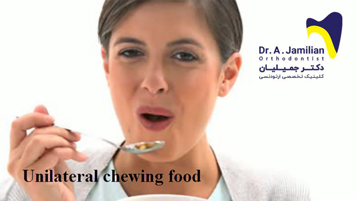 Unilateral Chewing Food Dr Jamilian