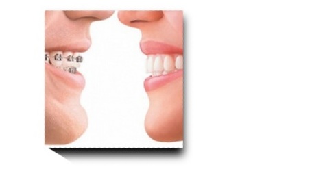 dental
