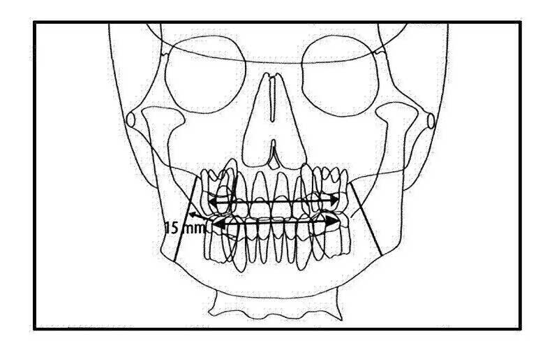 پلان دندانی