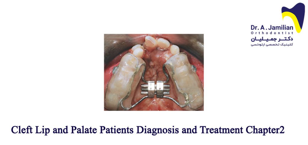 Cleft Lip And Palate Patients Diagnosis And Treatment Chapter2 Dr