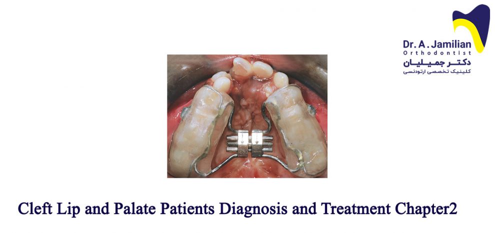 Cleft Lip And Palate Patients Diagnosis And Treatment Chapter2 Dr Jamilian 2160