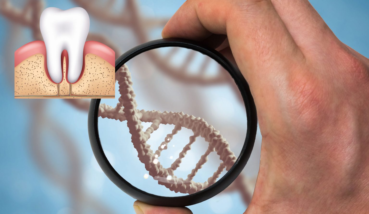 Six risk factors for periodontal diseases Risk factors for