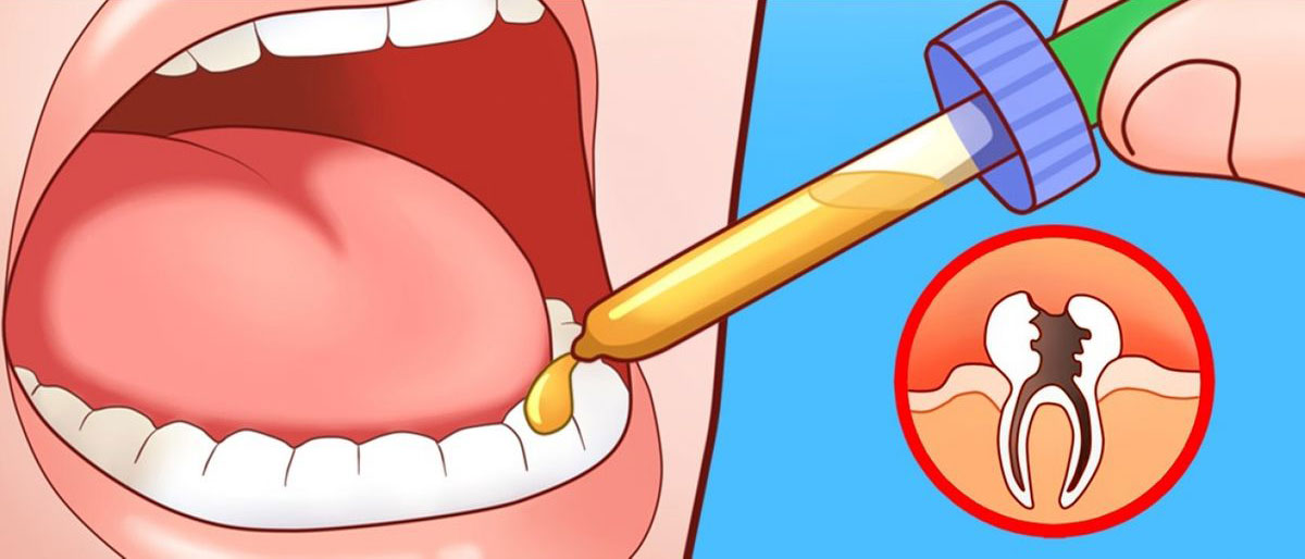 Herbal medicine drops for home dental treatment