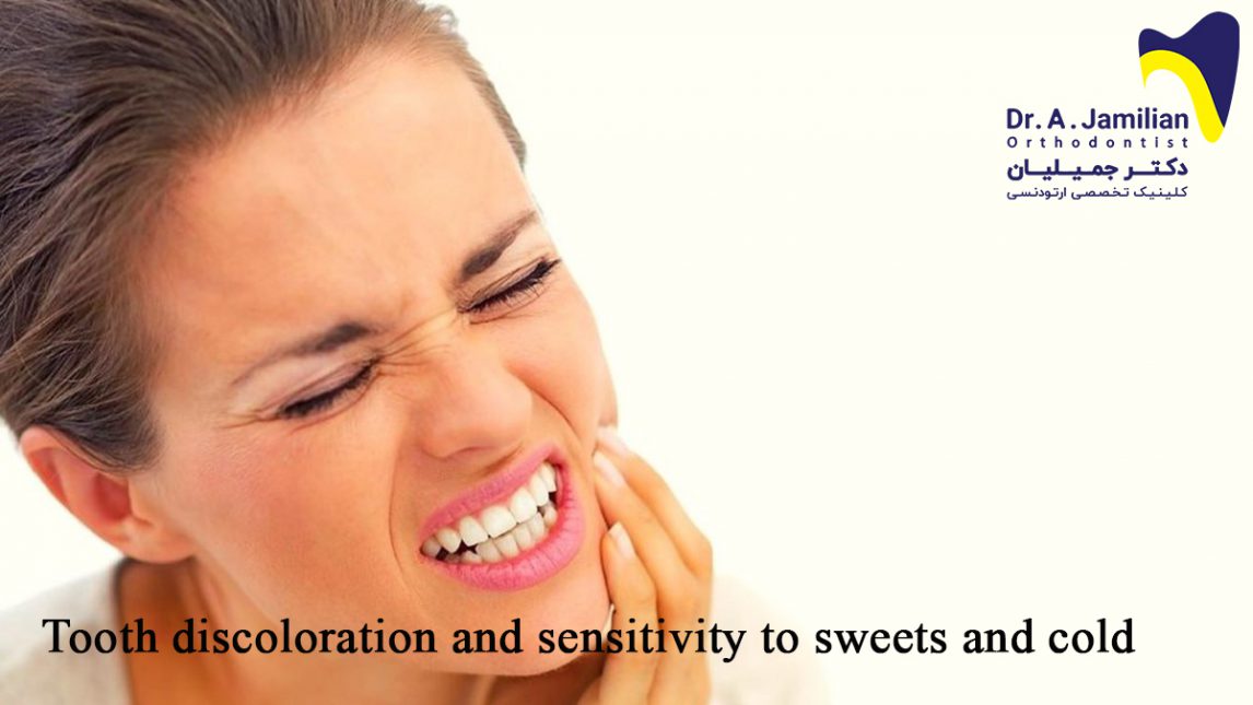 Tooth discoloration and sensitivity to sweets and cold Dr Jamilian