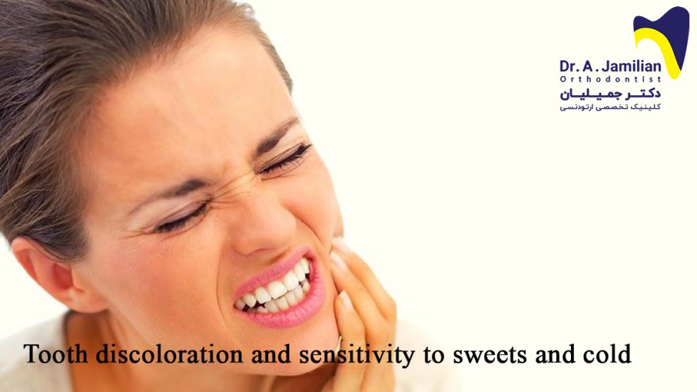 Tooth discoloration and sensitivity to sweets and cold Dr Jamilian
