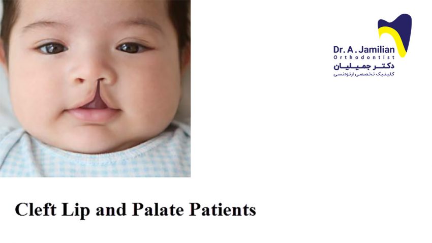 Cleft Lip and Palate Patients - Dr Jamilian