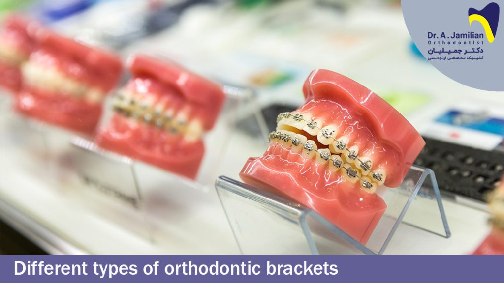 Different Types of Orthodontic Brackets Dr Jamilian