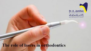 the role of lasers in orthodontics