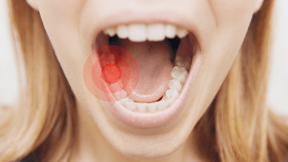 Zahnschmerzen nach endodontischer Behandlung