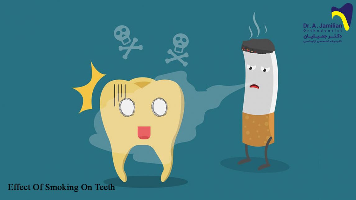 تأثير التدخين على الفم والأسنان الدکتور جمیلیان