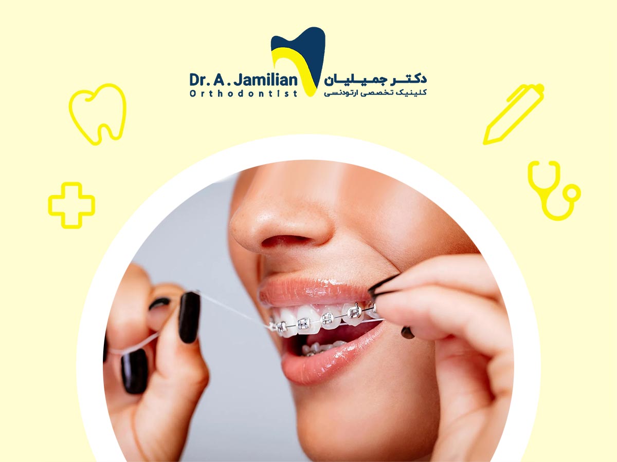 woman with orthodontic cleaning her teeth with dental floss