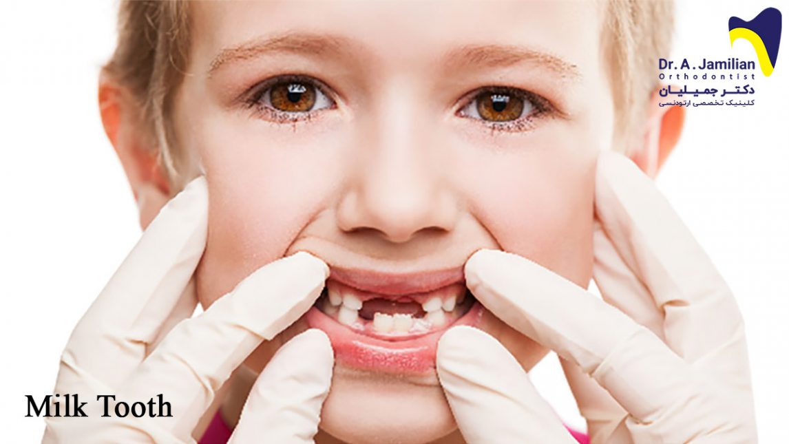 Milk teeth Dr Jamilian