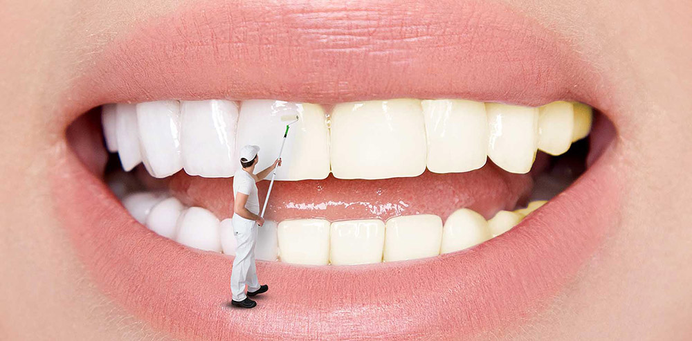 علاج البقع وتغير لون الأسنان