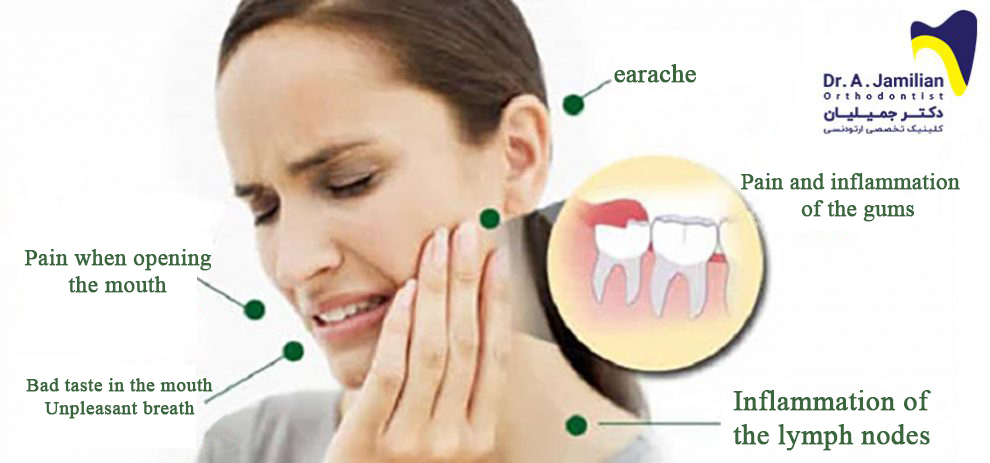 signs and complications of wisdom tooth pain