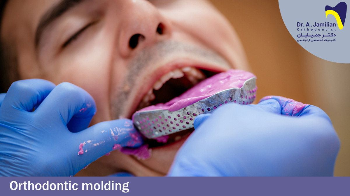 Orthodontic Molding Dr. Jamilian