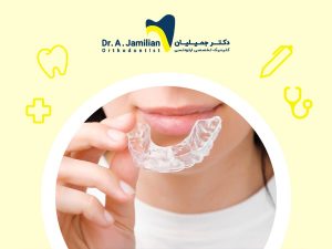 Close-up of a young woman holding a clear orthodontic retainer