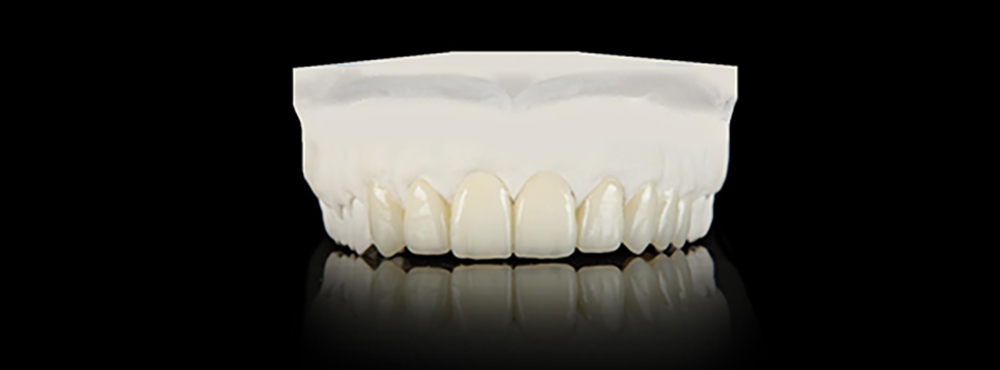 Orthodontic mold from the front view