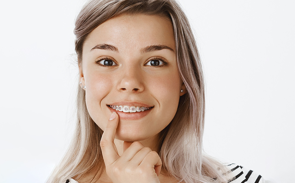 علاج تقويم الاسنان الأنثوي في وقت قصير