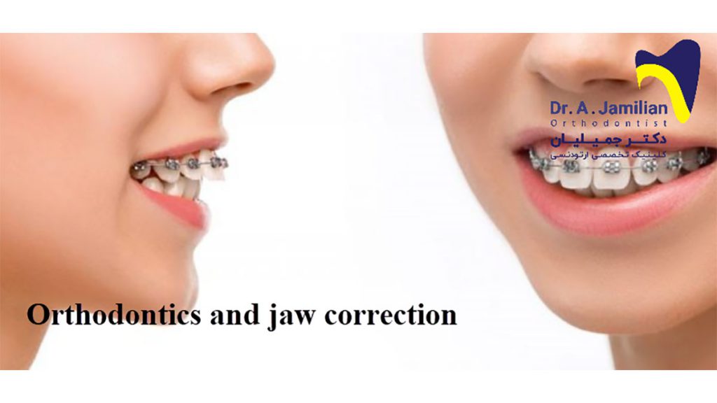Orthodontics And Jaw Correction Dr. Jamilian
