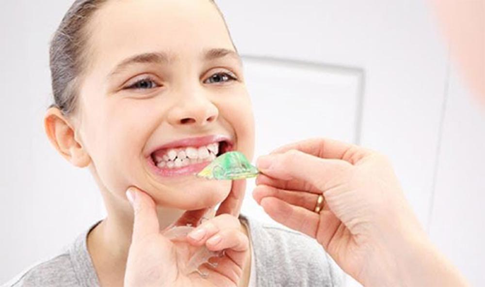 a little girl is putting a removable orthodontic appliance