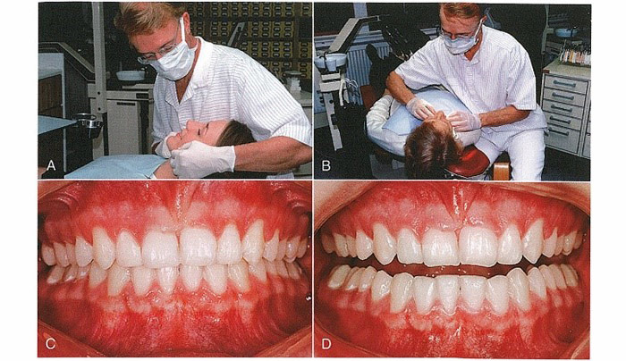 ارزیابی زیبایی دندان