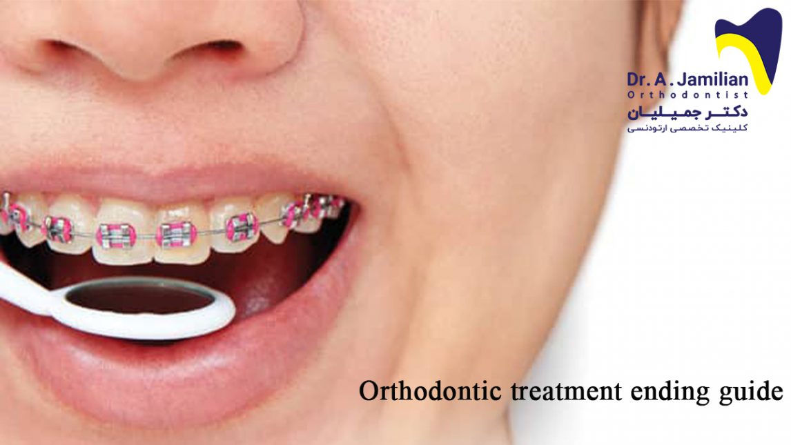 Orthodontic treatment ending guide Dr Jamilian