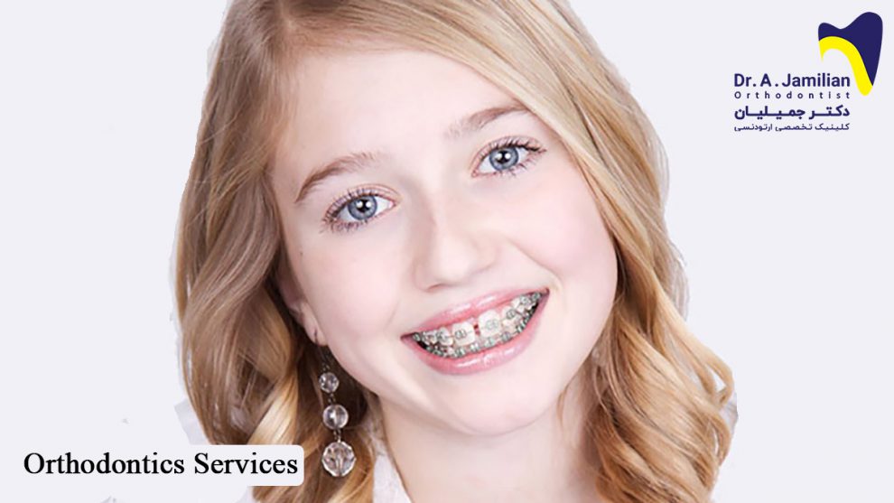 Orthodontic services Dr Jamilian