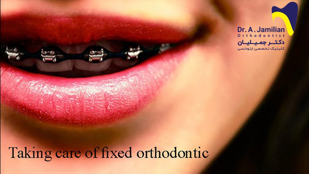 Taking care of fixed orthodontic - Dr Jamilian